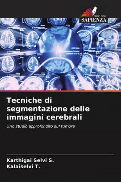 Tecniche di segmentazione delle immagini cerebrali