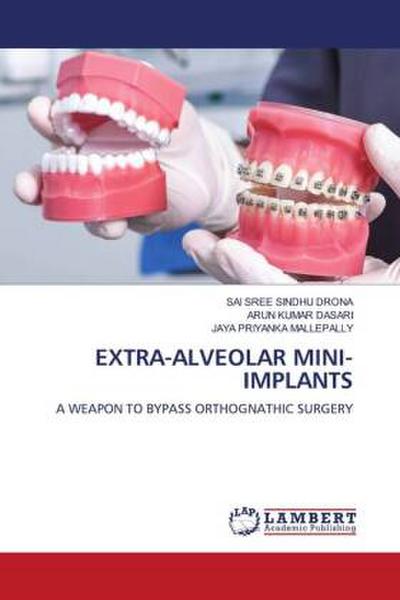 EXTRA-ALVEOLAR MINI-IMPLANTS