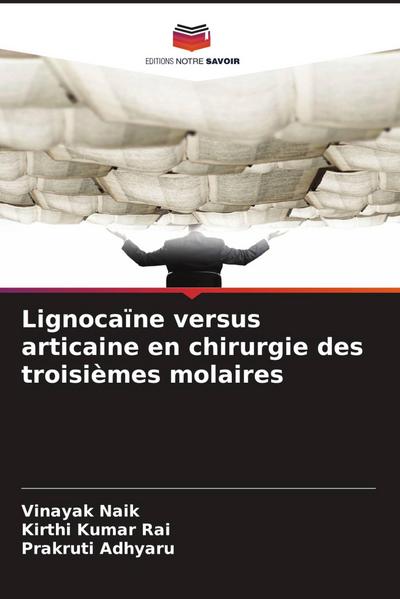 Lignocaïne versus articaine en chirurgie des troisièmes molaires