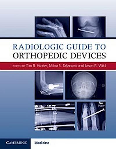 Radiologic Guide to Orthopedic Devices