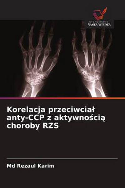 Korelacja przeciwcia¿ anty-CCP z aktywno¿ci¿ choroby RZS