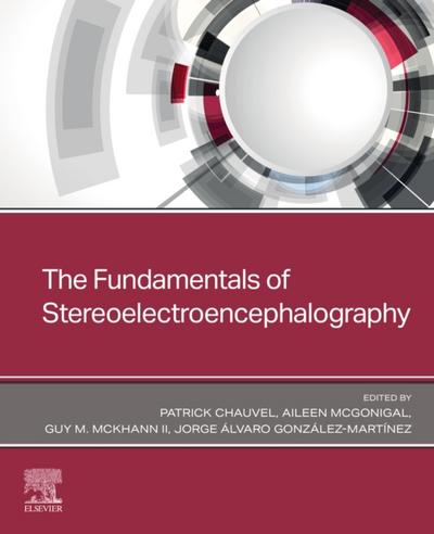 Fundamentals of Stereoelectroencephalography
