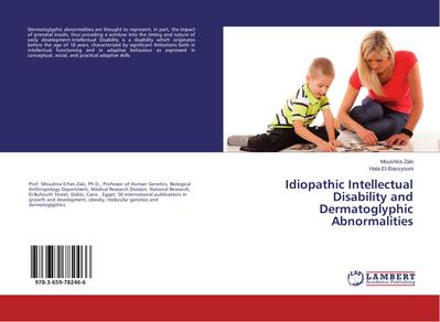 Idiopathic Intellectual Disability and Dermatoglyphic Abnormalities
