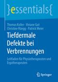 Tiefdermale Defekte bei Verbrennungen