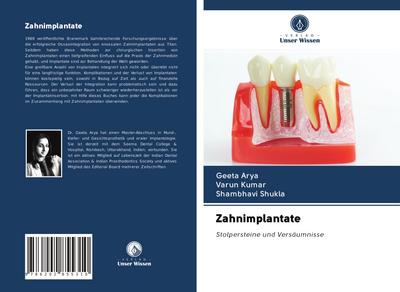 Zahnimplantate