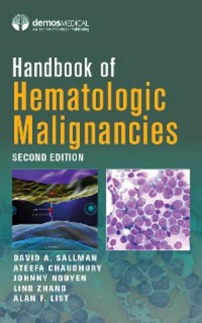 Handbook of Hematologic Malignancies