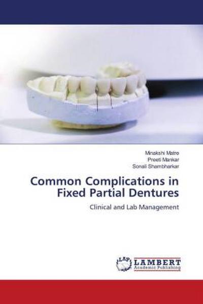Common Complications in Fixed Partial Dentures