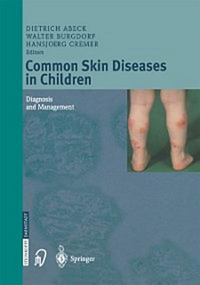 Common Skin Diseases in Children