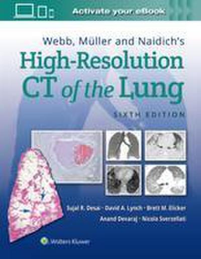 Webb, Muller and Naidich’s High Resolution of Lung CT