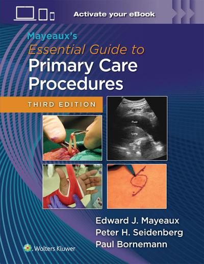 Mayeaux’s Essential Guide to Primary Care Procedures: Print + eBook with Multimedia