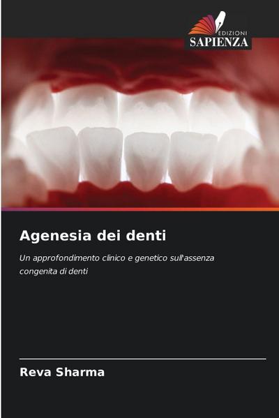 Agenesia dei denti