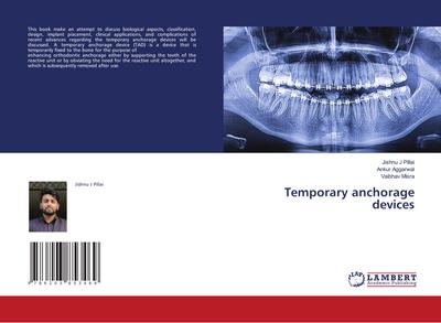 Temporary anchorage devices