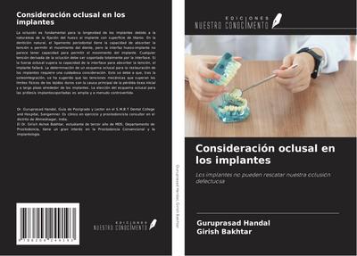 Consideración oclusal en los implantes