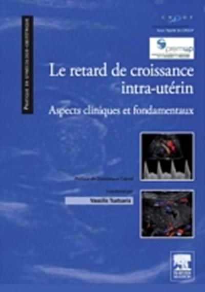Le retard de croissance intra-uterin
