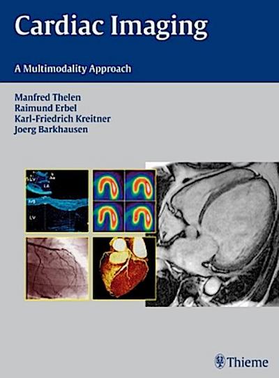 Cardiac Imaging