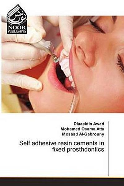 Self adhesive resin cements in fixed prosthdontics