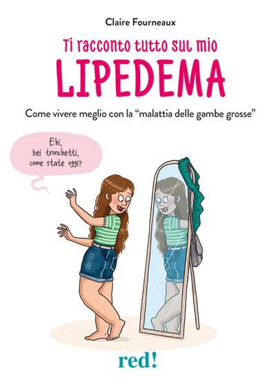 Ti racconto tutto sul mio lipedema. Come vivere meglio con la ’malattia delle gambe grosse’