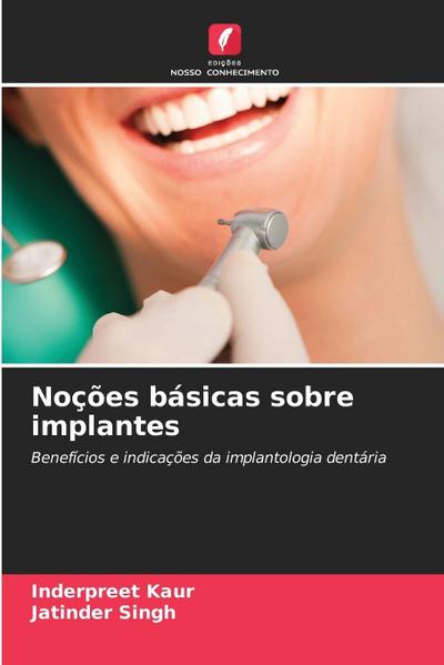 Noções básicas sobre implantes