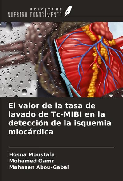 El valor de la tasa de lavado de Tc-MIBI en la detección de la isquemia miocárdica