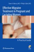 Effective Migraine Treatment in Pregnant and Lacta