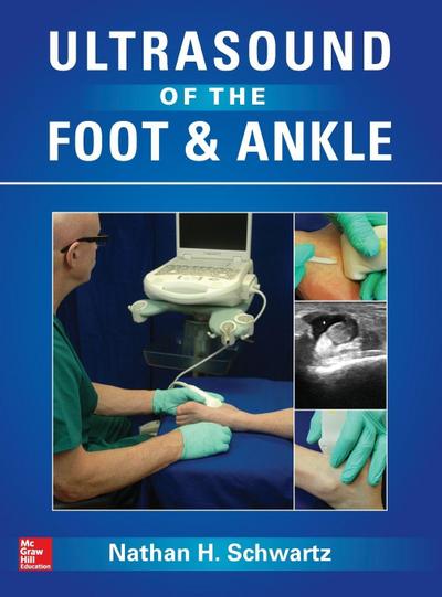 Ultrasound of the Foot and Ankle