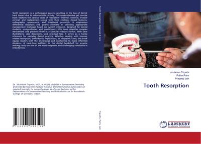 Tooth Resorption