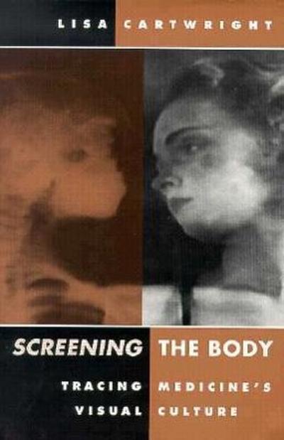 Screening the Body