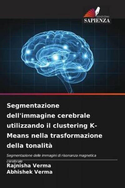 Segmentazione dell’immagine cerebrale utilizzando il clustering K-Means nella trasformazione della tonalità