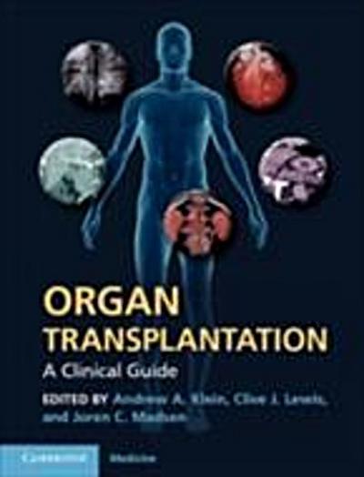 Organ Transplantation