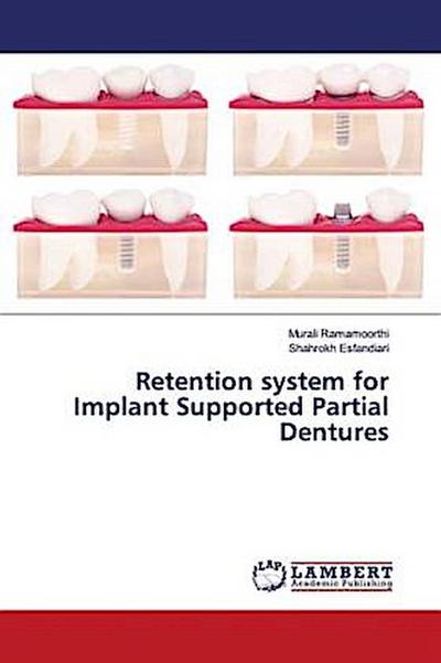 Retention system for Implant Supported Partial Dentures