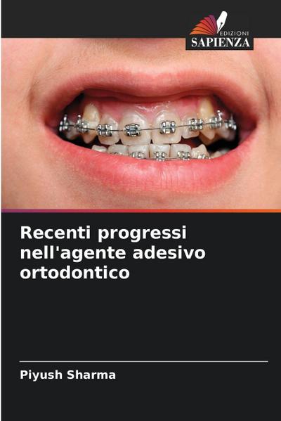 Recenti progressi nell’agente adesivo ortodontico