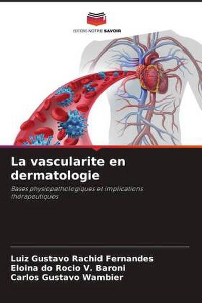 La vascularite en dermatologie