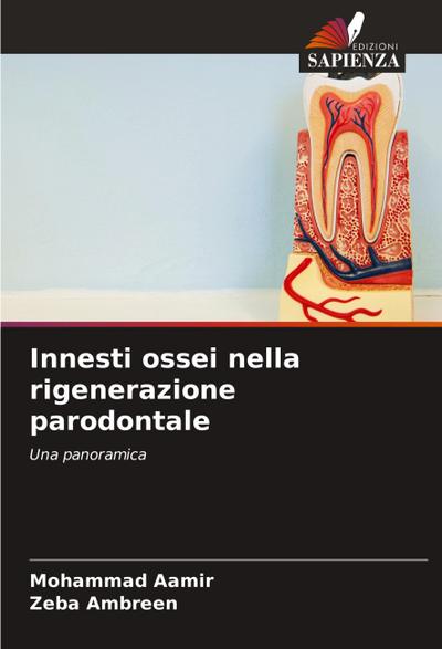 Innesti ossei nella rigenerazione parodontale