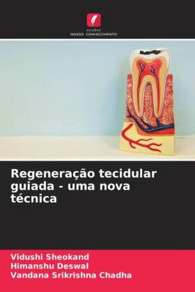 Regeneração tecidular guiada - uma nova técnica