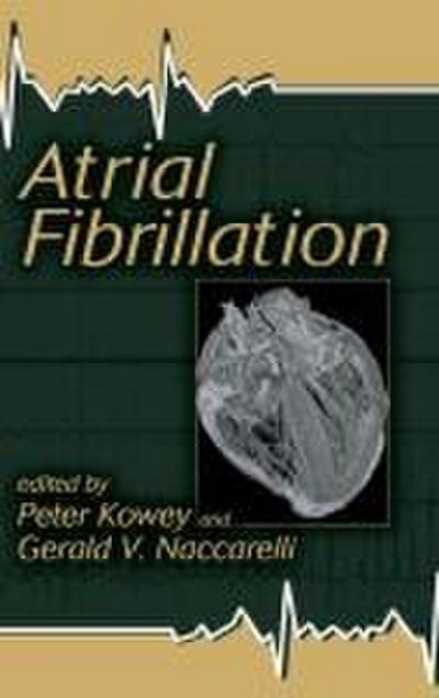 Atrial Fibrillation