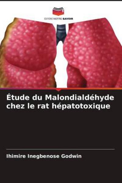 Étude du Malondialdéhyde chez le rat hépatotoxique