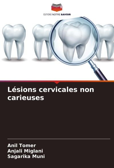 Lésions cervicales non carieuses