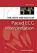 The Nuts and bolts of Paced ECG Interpretation