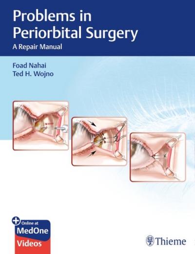 Problems in Periorbital Surgery