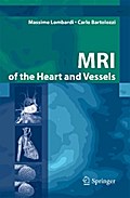 MRI of the Heart and Vessels