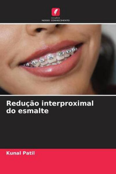 Redução interproximal do esmalte