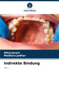 Indirekte Bindung