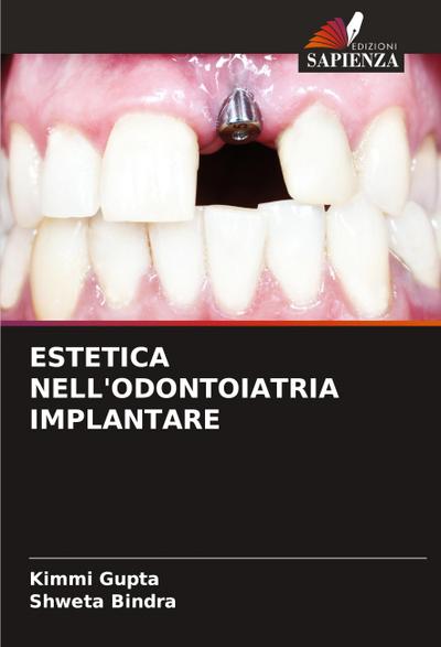 ESTETICA NELL’ODONTOIATRIA IMPLANTARE