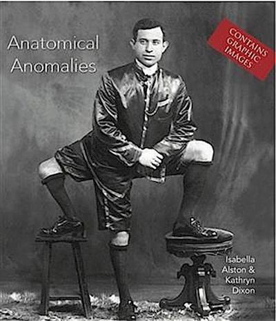 Anatomical Anomalies