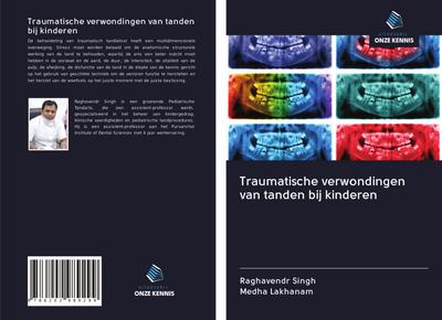 Traumatische verwondingen van tanden bij kinderen