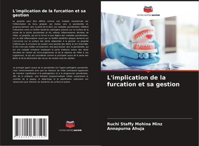 L’implication de la furcation et sa gestion