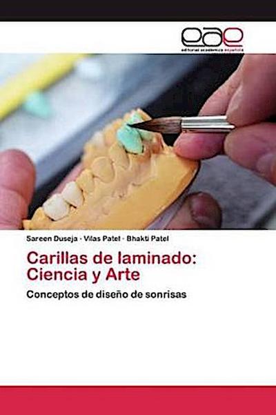 Carillas de laminado: Ciencia y Arte