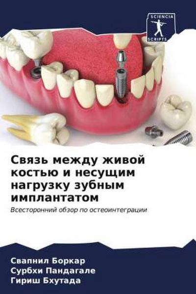 Swqz’ mezhdu zhiwoj kost’ü i nesuschim nagruzku zubnym implantatom