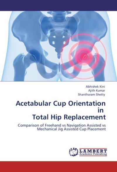 Acetabular Cup Orientation in Total Hip Replacement