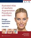 Illustrated Atlas of Aesthetic Augmentation Proced